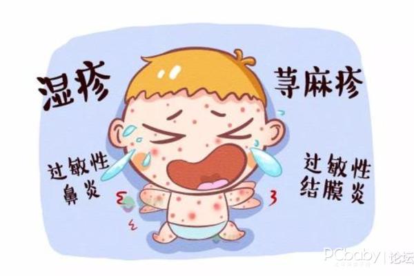 湿疹止痒妙招也有科学的方法，宝宝湿疹怎么引起的？