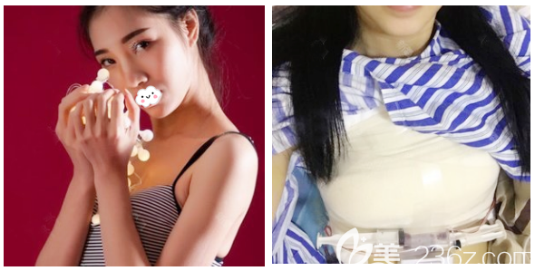 艾斯美假体 | 亮相中西医结合医学美容大会，创新双面假体技术引领乳房整形新趋势