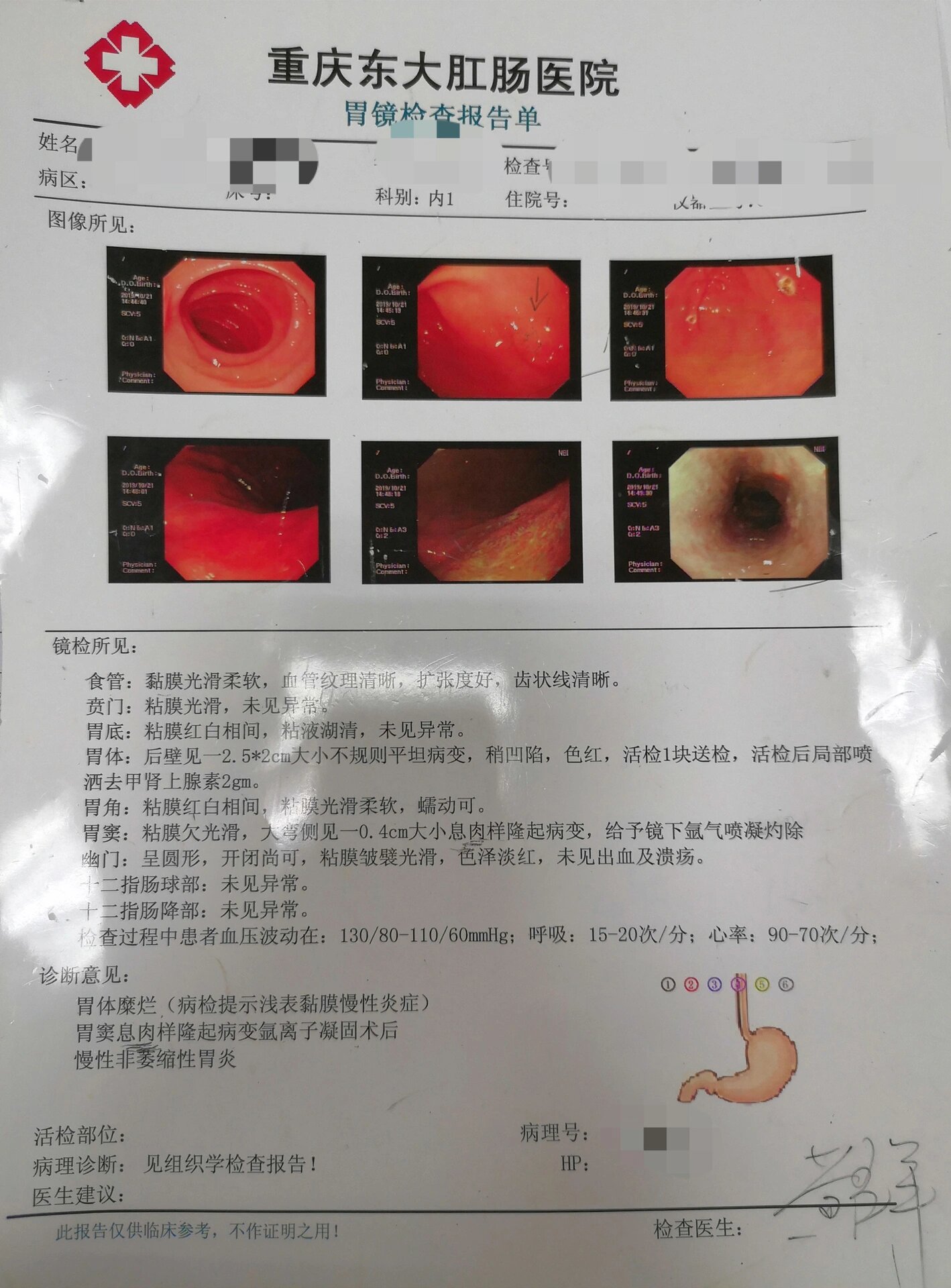 长春东大肛肠医院：关于胃肠镜的小秘密