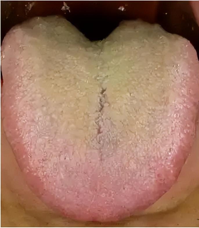 关节最怕冷，好医生骨痛灵酊助力正确“养骨”